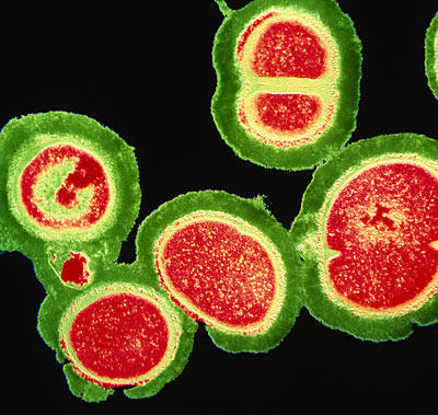 mercer staph infection