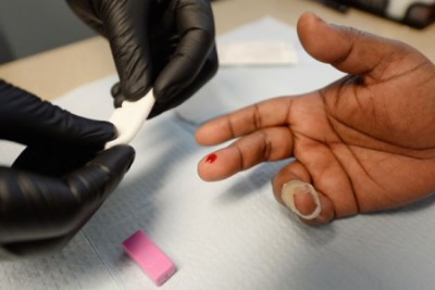 HIV/AIDS test