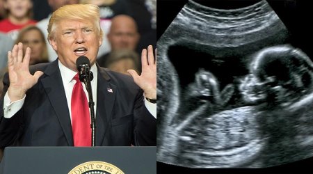President Trump and an ultrasound