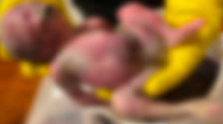 Blurred abortion pix