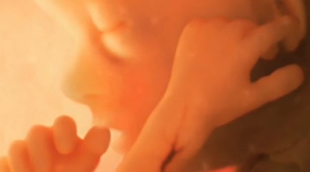 abortion