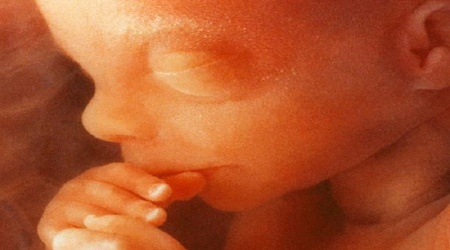 preborn