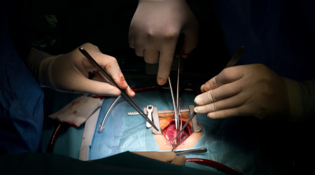 organs