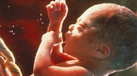 Massachusetts Passes Radical Bill for Abortions Up to Birth Massachusetts Passes Radical Bill for Abortions Up to Birth